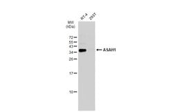 Invitrogen ASAH1 Polyclonal Antibody 100 &mu;L; Unconjugated:Antibodies,