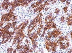 Invitrogen Galectin 4 Polyclonal Antibody 100 &mu;L; Unconjugated:Antibodies,