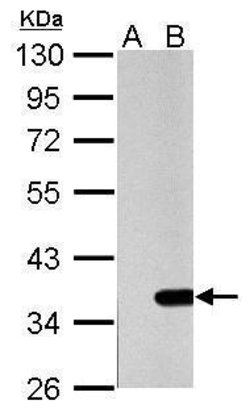 Invitrogen Galectin 4 Polyclonal Antibody 100 &mu;L; Unconjugated:Antibodies,