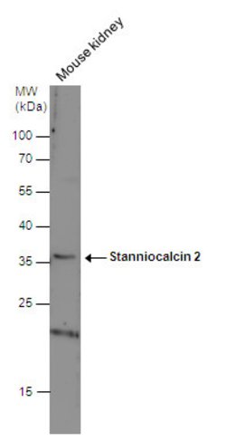 Invitrogen STC2 Polyclonal Antibody 100 &mu;L; Unconjugated:Antibodies,