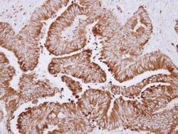 Invitrogen CES2 Polyclonal Antibody 100 &mu;L; Unconjugated:Antibodies,