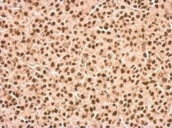 Invitrogen DDX23 Polyclonal Antibody 100 &mu;L; Unconjugated:Antibodies,