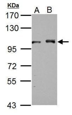 Invitrogen DDX23 Polyclonal Antibody 100 &mu;L; Unconjugated:Antibodies,