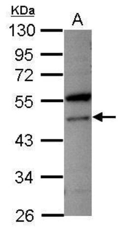 Invitrogen VPS4A Polyclonal Antibody 100 &mu;L; Unconjugated:Antibodies,