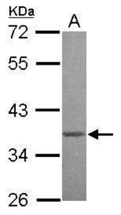 Invitrogen MBD3 Polyclonal Antibody 100 &mu;L | Buy Online | Invitrogen&trade; | Fisher Scientific