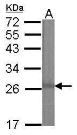 Invitrogen MBD3 Polyclonal Antibody 100 &mu;L | Buy Online | Invitrogen&trade; | Fisher Scientific