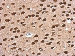 Invitrogen CUG-BP2 Polyclonal Antibody 100 &mu;L; Unconjugated:Antibodies,