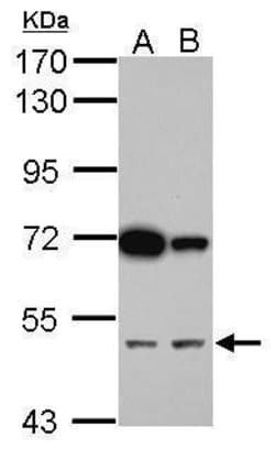 Invitrogen CUG-BP2 Polyclonal Antibody 100 &mu;L; Unconjugated:Antibodies,