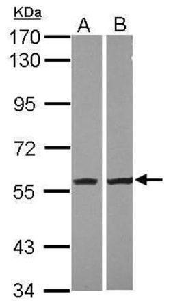 Invitrogen NAMPT Polyclonal Antibody 100 &mu;L; Unconjugated:Antibodies,