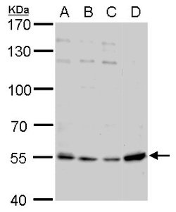 Invitrogen NAMPT Polyclonal Antibody 100 &mu;L; Unconjugated:Antibodies,
