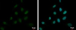 Invitrogen DEPDC1 Polyclonal Antibody 100 &mu;L; Unconjugated:Antibodies,