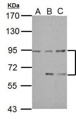 Invitrogen DEPDC1 Polyclonal Antibody 100 &mu;L; Unconjugated:Antibodies,