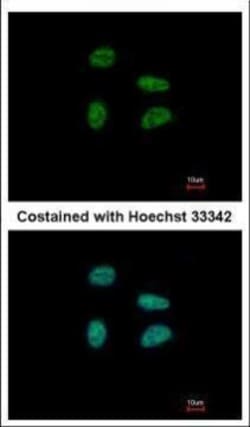 Invitrogen GAS41 Polyclonal Antibody 100 &mu;L; Unconjugated:Antibodies,
