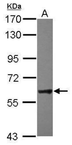 Invitrogen NXF2 Polyclonal Antibody 100 &mu;L; Unconjugated:Antibodies,