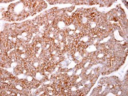 Invitrogen ARPC1A Polyclonal Antibody 100 &mu;L; Unconjugated:Antibodies,