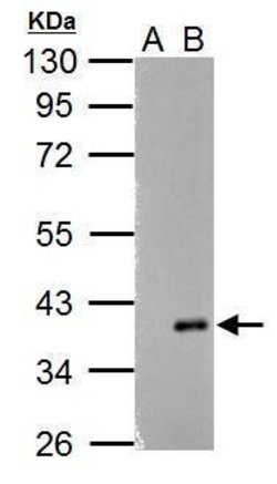 Invitrogen ARPC1A Polyclonal Antibody 100 &mu;L; Unconjugated:Antibodies,