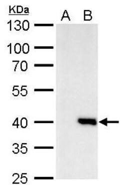 Invitrogen Macro H2A.2 Polyclonal Antibody 100 &mu;L; Unconjugated:Antibodies,