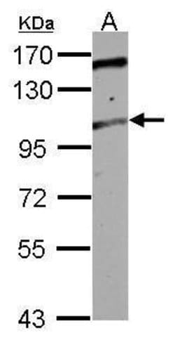 Invitrogen TRAK2 Polyclonal Antibody 100 &mu;L; Unconjugated:Antibodies,