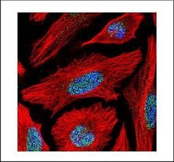 Invitrogen BAF53B Polyclonal Antibody 100 &mu;L | Buy Online | Invitrogen&trade; | Fisher Scientific