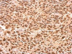 Invitrogen RED Polyclonal Antibody 100 &mu;L; Unconjugated:Antibodies,