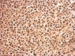 Invitrogen RED Polyclonal Antibody 100 &mu;L; Unconjugated:Antibodies,