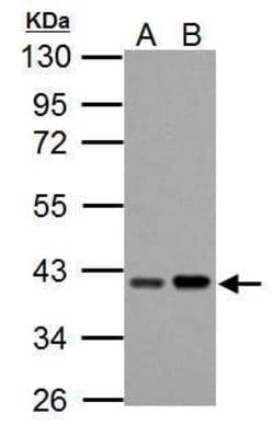 Invitrogen PECI Polyclonal Antibody 100 &mu;L | Buy Online | Invitrogen&trade; | Fisher Scientific