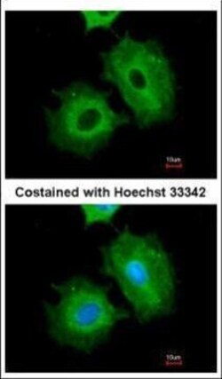 Invitrogen ALDH1A1 Polyclonal Antibody 100 &mu;L | Buy Online | Invitrogen&trade; | Fisher Scientific