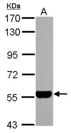 Invitrogen ALDH1A1 Polyclonal Antibody 100 &mu;L | Buy Online | Invitrogen&trade; | Fisher Scientific