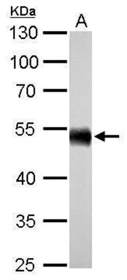 Invitrogen ALDH1A1 Polyclonal Antibody 100 &mu;L | Buy Online | Invitrogen&trade; | Fisher Scientific