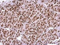 Invitrogen H3R17me2a Polyclonal Antibody 100 &mu;L; Unconjugated:Antibodies,