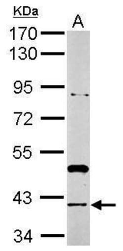 Invitrogen RAD51 Polyclonal Antibody 100 &mu;L; Unconjugated:Antibodies,