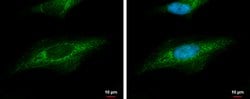 Invitrogen beta Dystroglycan Polyclonal Antibody 100 &mu;L; Unconjugated:Antibodies,
