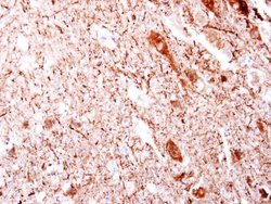 Invitrogen beta Dystroglycan Polyclonal Antibody 100 &mu;L; Unconjugated:Antibodies,