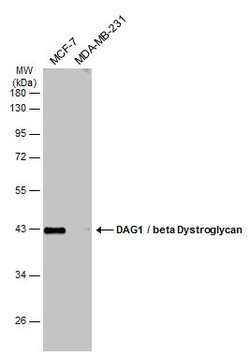 Invitrogen beta Dystroglycan Polyclonal Antibody 100 &mu;L; Unconjugated:Antibodies,