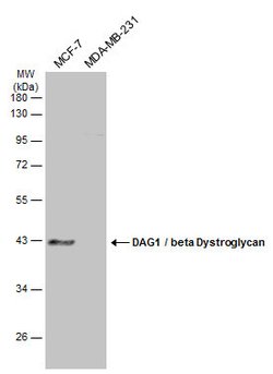 Invitrogen beta Dystroglycan Polyclonal Antibody 100 &mu;L; Unconjugated:Antibodies,