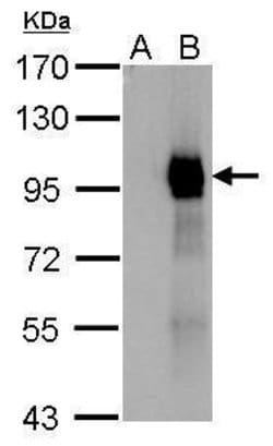 Invitrogen Paxillin Polyclonal Antibody 100 &mu;L | Buy Online | Invitrogen&trade; | Fisher Scientific