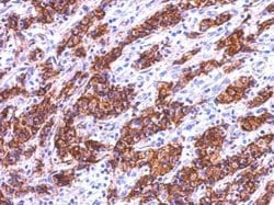 Invitrogen Galectin 4 Polyclonal Antibody 100 &mu;L; Unconjugated:Antibodies,