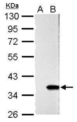Invitrogen Galectin 4 Polyclonal Antibody 100 &mu;L; Unconjugated:Antibodies,
