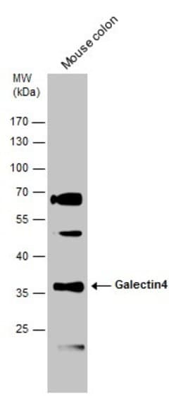 Invitrogen Galectin 4 Polyclonal Antibody 100 &mu;L; Unconjugated:Antibodies,