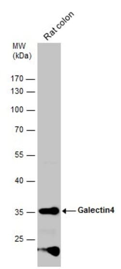 Invitrogen Galectin 4 Polyclonal Antibody 100 &mu;L; Unconjugated:Antibodies,