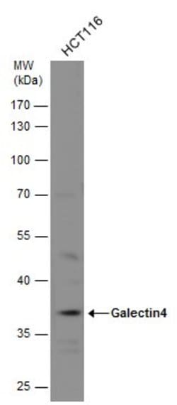 Invitrogen Galectin 4 Polyclonal Antibody 100 &mu;L; Unconjugated:Antibodies,