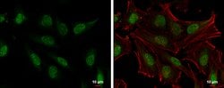 Invitrogen SLU7 Polyclonal Antibody 100 &mu;L; Unconjugated:Antibodies,
