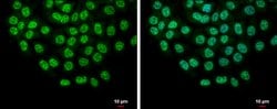 Invitrogen SLU7 Polyclonal Antibody 100 &mu;L; Unconjugated:Antibodies,