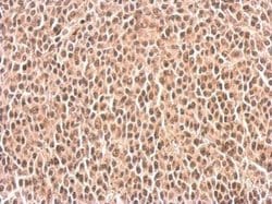 Invitrogen SLU7 Polyclonal Antibody 100 &mu;L; Unconjugated:Antibodies,