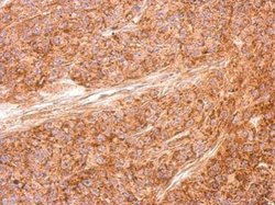 Invitrogen AID Polyclonal Antibody 100 &mu;L; Unconjugated:Antibodies,