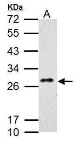 Invitrogen CLEC5A Polyclonal Antibody 100 &mu;L; Unconjugated:Anticuerpos