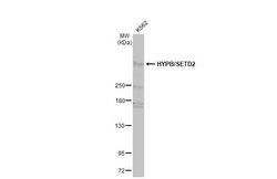 Invitrogen SETD2 Polyclonal Antibody 100 &mu;L; Unconjugated:Antibodies,