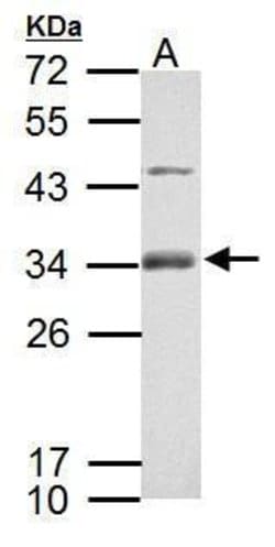 Invitrogen&trade;&nbsp;RSPO1 Polyclonal Antibody