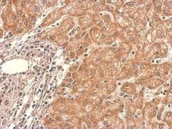 Invitrogen PAK6 Polyclonal Antibody 100 &mu;L; Unconjugated:Antibodies,