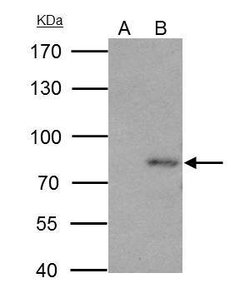 Invitrogen PAK6 Polyclonal Antibody 100 &mu;L; Unconjugated:Antibodies,